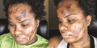 What’s the Deal with Skin Bleaching and How is it Still Happening?